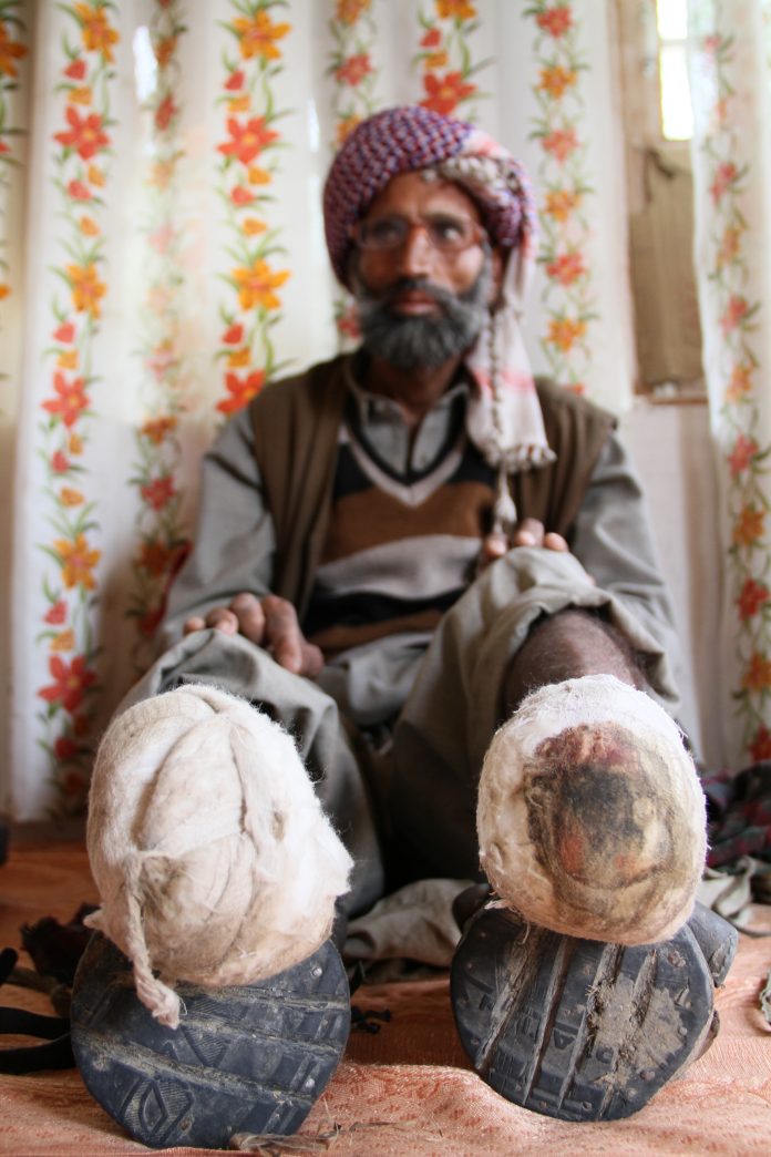 India military personnel in occupied Kashmir are promised total impunity and given special powers by the The Armed Forces (Jammu and Kashmir) Special Powers Act 1990. (World Without Torture photo)