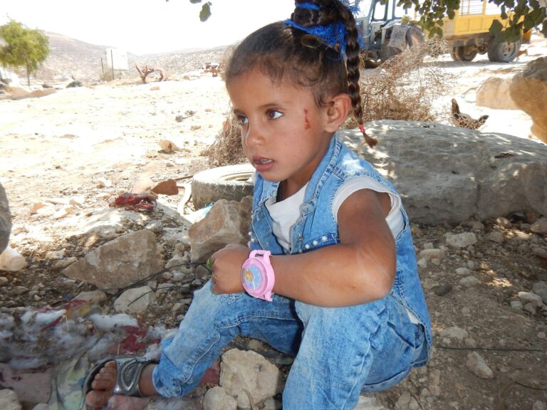 A little girl is wounded from a settler attack in the West Bank in 2021. This year, hate crimes in the US have increased 172%, including those against children. Credit: מנאל אל-ג'עברי